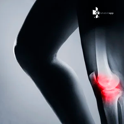 RX RODILLA 