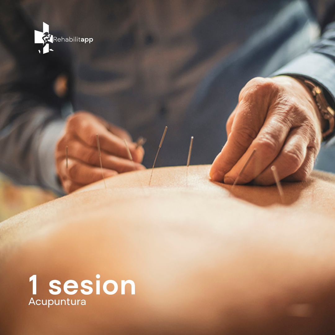 1 SESION DE ACUPUNTURA